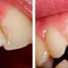 Business 10 image HEALTHY SMILE DENTAL CARE TMJ Treatment in Oakland CA