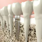 Business 11 image HEALTHY SMILE DENTAL CARE TMJ Treatment in Oakland CA