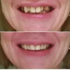Business 2 image HERALD SQUARE DENTAL & THE DENTURE CENTER Dental Hygienists in New York NY