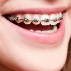 Business 3 image HULME ORTHODONTICS Orthodontists in San Antonio TX