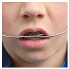 Business 4 image HULME ORTHODONTICS Orthodontists in San Antonio TX