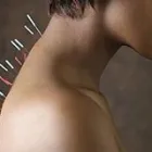 Business 1 image INTEGRATIVE WELLNESS CLINIC Cupping Services in San Antonio TX