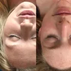 Business 4 image JADE FACIAL LOUNGE Derma Planing in Pittsburgh PA