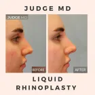 Business 2 image JUDGE MD Cosmetic Surgery in San Francisco CA