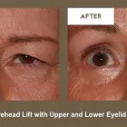 Business 1 image KLAPPER EYELID AND FACIAL PLASTIC SURGERY Plastic Surgery in Indianapolis IN