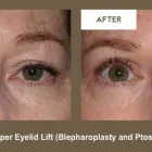 Business 3 image KLAPPER EYELID AND FACIAL PLASTIC SURGERY Plastic Surgery in Indianapolis IN