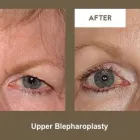 Business 4 image KLAPPER EYELID AND FACIAL PLASTIC SURGERY Plastic Surgery in Indianapolis IN