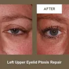 Business 6 image KLAPPER EYELID AND FACIAL PLASTIC SURGERY Plastic Surgery in Indianapolis IN