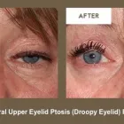 Business 7 image KLAPPER EYELID AND FACIAL PLASTIC SURGERY Plastic Surgery in Indianapolis IN