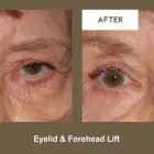 Business 8 image KLAPPER EYELID AND FACIAL PLASTIC SURGERY Plastic Surgery in Indianapolis IN