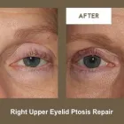 Business 10 image KLAPPER EYELID AND FACIAL PLASTIC SURGERY Plastic Surgery in Indianapolis IN