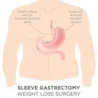 Business 3 image LAP BAND SURGERY Weight Loss in Miami FL