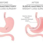 Business 4 image LAP BAND SURGERY Weight Loss in Miami FL