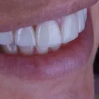 Business 3 image LEGACY DENTAL GROUP Periodontal Treatment in Birmingham MI
