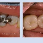 Business 8 image LEO ARELLANO DDS PC Teeth Whitening Products & Services in San Francisco CA