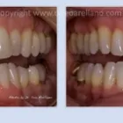Business 2 image LEO ARELLANO DDS PC Teeth Whitening Products & Services in San Francisco CA