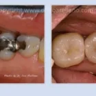 Business 10 image LEO ARELLANO DDS PC Teeth Whitening Products & Services in San Francisco CA