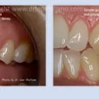 Business 4 image LEO ARELLANO DDS PC Teeth Whitening Products & Services in San Francisco CA