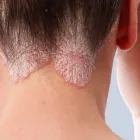 Business 16 image MAGNOLIA MEDICAL & AESTHETICS Tattoo Removal in San Antonio TX