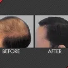 Business 1 image MAXIM HAIR RESTORATION Hair Transplant in Houston TX