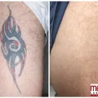 Business 2 image MEDERMIS LASER CLINIC in San Antonio TX