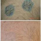 Business 3 image MEDERMIS LASER CLINIC in San Antonio TX