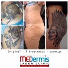 Business 4 image MEDERMIS LASER CLINIC in San Antonio TX