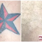 Business 7 image MEDERMIS LASER CLINIC in San Antonio TX