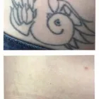 Business 8 image MEDERMIS LASER CLINIC in San Antonio TX