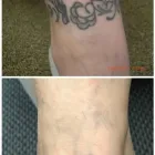 Business 9 image MEDERMIS LASER CLINIC in San Antonio TX