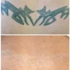 Business 12 image MEDERMIS LASER CLINIC in San Antonio TX