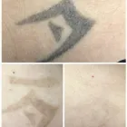 Business 13 image MEDERMIS LASER CLINIC in San Antonio TX