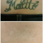 Business 14 image MEDERMIS LASER CLINIC in San Antonio TX