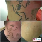 Business 17 image MEDERMIS LASER CLINIC in San Antonio TX