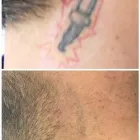 Business 18 image MEDERMIS LASER CLINIC in San Antonio TX