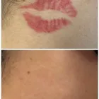 Business 19 image MEDERMIS LASER CLINIC in San Antonio TX