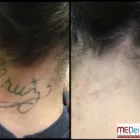 Business 20 image MEDERMIS LASER CLINIC in San Antonio TX