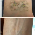 Business 25 image MEDERMIS LASER CLINIC in San Antonio TX