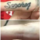 Business 30 image MEDERMIS LASER CLINIC in San Antonio TX