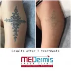 Business 34 image MEDERMIS LASER CLINIC in San Antonio TX