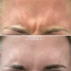 Business 1 image METRO MEDSPA Skin Care Clinic in St. Louis MO