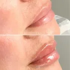 Business 2 image METRO MEDSPA Skin Care Clinic in St. Louis MO