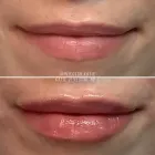 Business 3 image METRO MEDSPA Skin Care Clinic in St. Louis MO