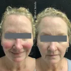 Business 4 image METRO MEDSPA Skin Care Clinic in St. Louis MO