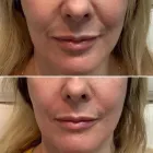 Business 5 image METRO MEDSPA Skin Care Clinic in St. Louis MO