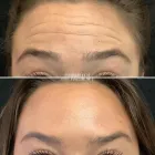 Business 6 image METRO MEDSPA Skin Care Clinic in St. Louis MO