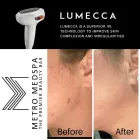 Business 12 image METRO MEDSPA Skin Care Clinic in St. Louis MO