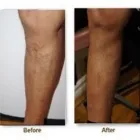 Business 3 image METROPOLITAN VEIN AND AESTHETIC CENTER Varicose Vein Removal in Corona NY