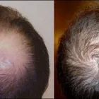 Business 5 image METROPOLITAN VEIN AND AESTHETIC CENTER Varicose Vein Removal in Corona NY