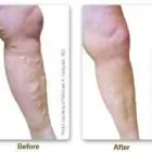 Business 2 image METROPOLITAN VEIN AND AESTHETIC CENTER Medical Spa in Yonkers NY